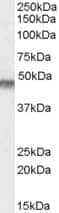 Western Blot: Kir6.2 Antibody [NBP1-00206]