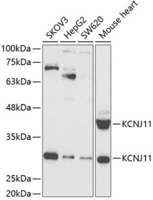 Western Blot: Kir6.2 AntibodyBSA Free [NBP3-03506]