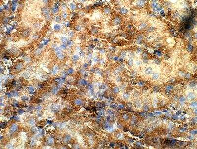 Immunohistochemistry-Paraffin: Kirrel1/NEPH1 Antibody [NBP3-12277]