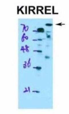 Western Blot: Kirrel1/NEPH1 Antibody [NBP1-91309]