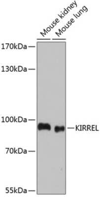 Western Blot: Kirrel1/NEPH1 AntibodyAzide and BSA Free [NBP3-03509]