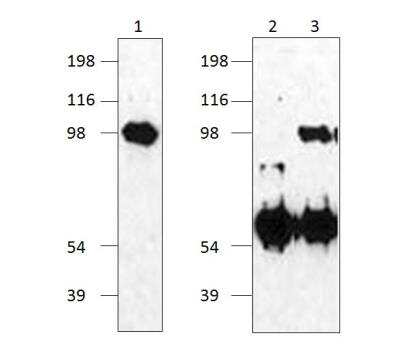 Western Blot: Kirrel1/NEPH1 Antibody [NBP3-12254]