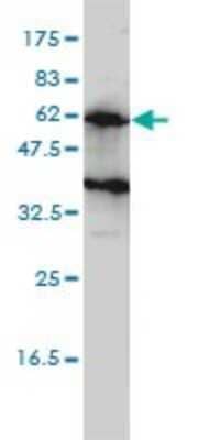 Western Blot: Kirrel2/NEPH3 Antibody (2B9-1D3) [H00084063-M01]