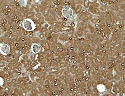 Immunohistochemistry: Kirrel3/NEPH2 Antibody - BSA Free [NBP2-82000]