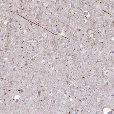Immunohistochemistry-Paraffin: Kirrel3/NEPH2 Antibody [NBP2-38788]