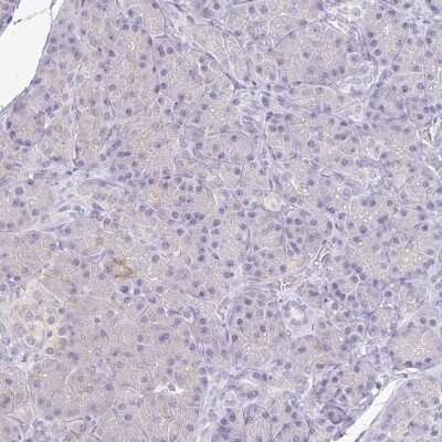 Immunohistochemistry-Paraffin: Kirrel3/NEPH2 Antibody [NBP2-38788]