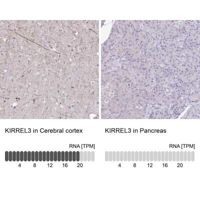 Immunohistochemistry-Paraffin: Kirrel3/NEPH2 Antibody [NBP2-38788]