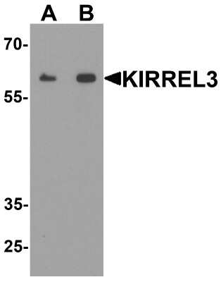 Western Blot: Kirrel3/NEPH2 AntibodyBSA Free [NBP2-82000]