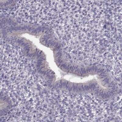 Immunohistochemistry-Paraffin: Klkbl4 Antibody [NBP1-88043]