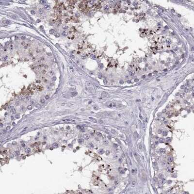Immunohistochemistry-Paraffin: Klkbl4 Antibody [NBP1-88043]