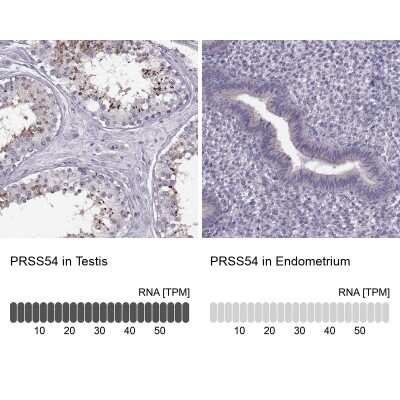 Immunohistochemistry-Paraffin: Klkbl4 Antibody [NBP1-88043]