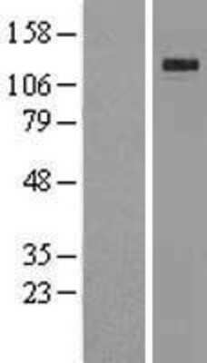 Western Blot: Klotho Overexpression Lysate [NBL1-12307]