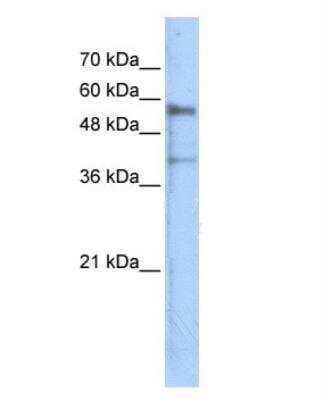 Western Blot: Kremen-1 Antibody [NBP1-59371]