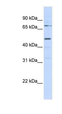 Western Blot: Kremen-1 Antibody [NBP1-59717]