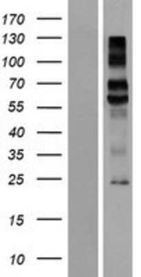 Western Blot: Kremen-1 Overexpression Lysate [NBP2-08578]