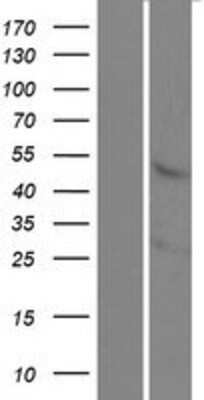 Western Blot: Kremen-1 Overexpression Lysate [NBP2-09928]