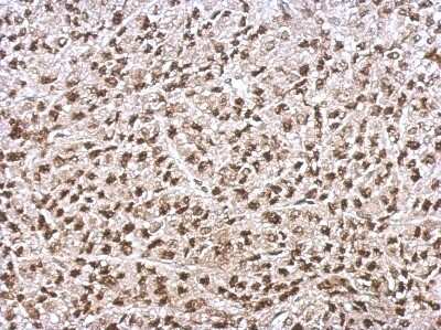 Immunohistochemistry-Paraffin: Ku70/XRCC6 Antibody [NBP2-19311]
