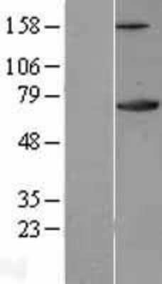 Western Blot: Ku70/XRCC6 Overexpression Lysate [NBL1-17919]