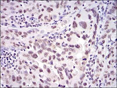 Immunohistochemistry-Paraffin: Ku70/XRCC6 Antibody (2F7F5) - BSA Free [NBP2-52589]