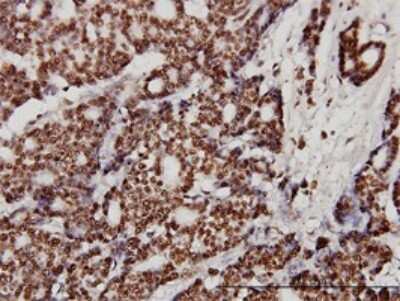 Immunohistochemistry-Paraffin: Ku70/XRCC6 Antibody (4C2-1A6) [H00002547-M01]