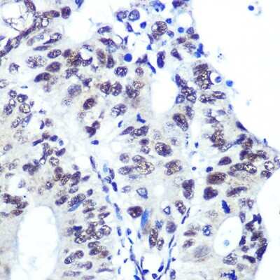 Immunohistochemistry-Paraffin: Ku70/XRCC6 Antibody (8L6B6) [NBP3-15358]