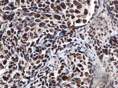 Immunohistochemistry-Paraffin: Ku70/XRCC6 Antibody [NBP2-19311]