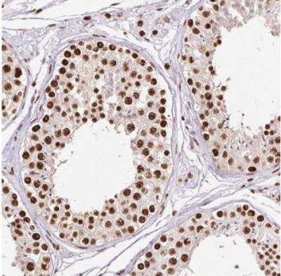 Immunohistochemistry-Paraffin: Ku70/XRCC6 Antibody [NBP2-38567]