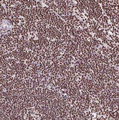 Immunohistochemistry-Paraffin: Ku70/XRCC6 Antibody [NBP2-38567]