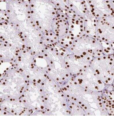 Immunohistochemistry-Paraffin: Ku70/XRCC6 Antibody [NBP2-38567]