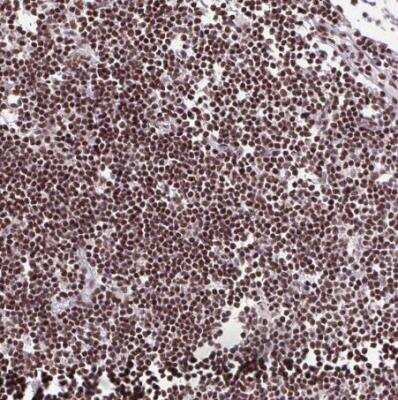 Immunohistochemistry-Paraffin: Ku70/XRCC6 Antibody [NBP2-38954]