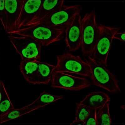 Immunocytochemistry/ Immunofluorescence: Ku70/XRCC6 Antibody (KU729) - Azide and BSA Free [NBP2-34663]