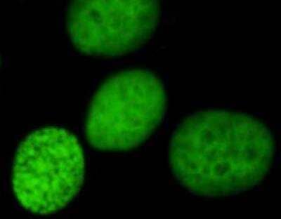 Immunocytochemistry/ Immunofluorescence: Ku70/XRCC6 Antibody (KU729) [NBP2-34247]