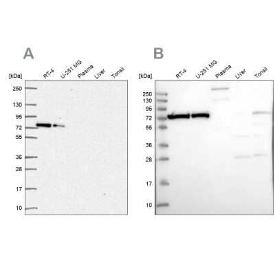 Western Blot: Ku70/XRCC6 Antibody [NBP2-38954]