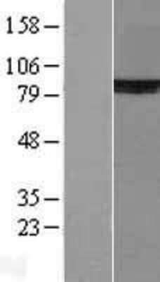 Western Blot: Ku80/XRCC5 Overexpression Lysate [NBL1-17918]