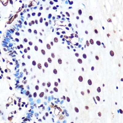 Immunohistochemistry-Paraffin: Ku80/XRCC5 Antibody (7N7G3) [NBP3-15448]
