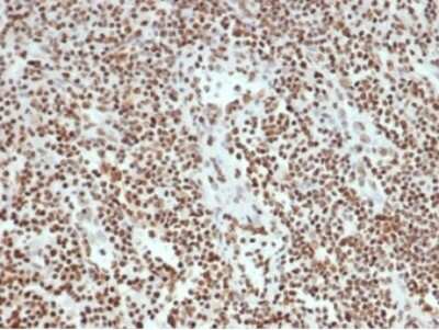 Immunohistochemistry-Paraffin: Ku80/XRCC5 Antibody (XRCC5/7315) [NBP3-13795]