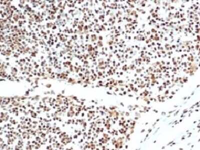 Immunohistochemistry-Paraffin: Ku80/XRCC5 Antibody (XRCC5/7317) [NBP3-13796]