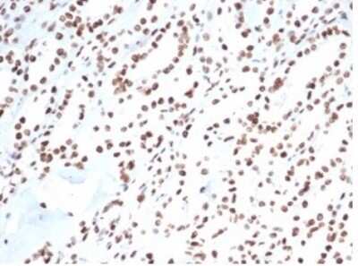 Immunohistochemistry-Paraffin: Ku80/XRCC5 Antibody (XRCC5/7317) [NBP3-13796]