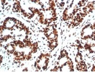 Immunohistochemistry-Paraffin: Ku80/XRCC5 Antibody (XRCC5/7317) [NBP3-13796]
