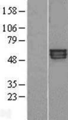 Western Blot: Kv1.1 Overexpression Lysate [NBL1-12137]