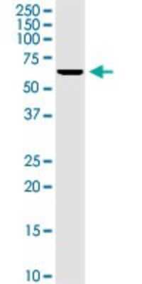 Western Blot: Kv1.3 Antibody (1D8) [H00003738-M01]