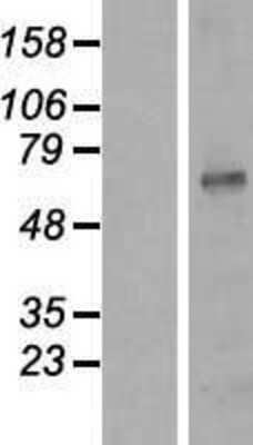 Western Blot: Kv1.3 Overexpression Lysate [NBP2-10816]