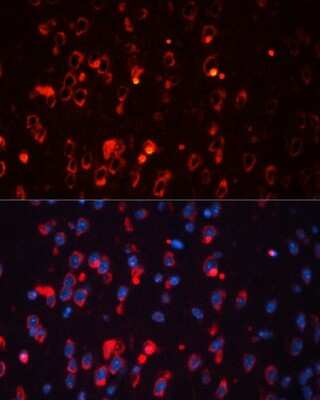 Immunohistochemistry: Kv1.1 Antibody - Azide and BSA Free [NBP3-03729]