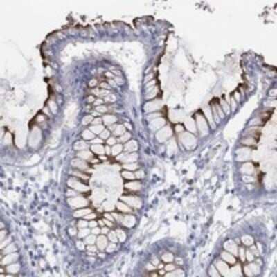 Immunohistochemistry-Paraffin: Kv1.1 Antibody [NBP3-17729]