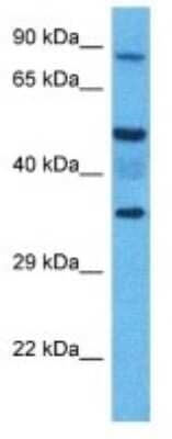 Western Blot: Kv1.2 Antibody [NBP3-10293]