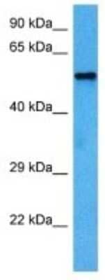 Western Blot: Kv1.2 Antibody [NBP3-10294]