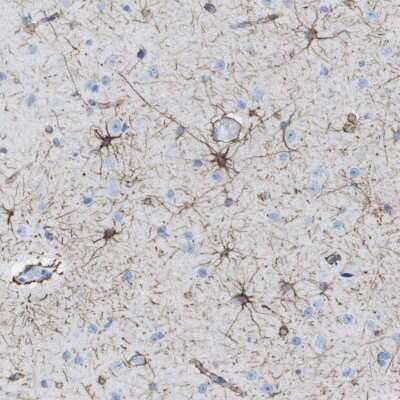 Immunohistochemistry-Paraffin: Kv1.3 Antibody [NBP2-48533]