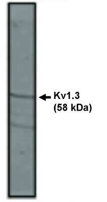 Western Blot: Kv1.3 Antibody [NBP3-11898]