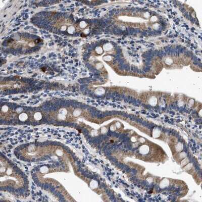 Immunohistochemistry-Paraffin: Kv1.4 Antibody [NBP1-89691]