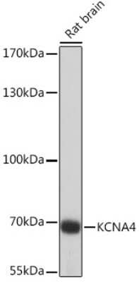 Western Blot: Kv1.4 AntibodyAzide and BSA Free [NBP3-02980]